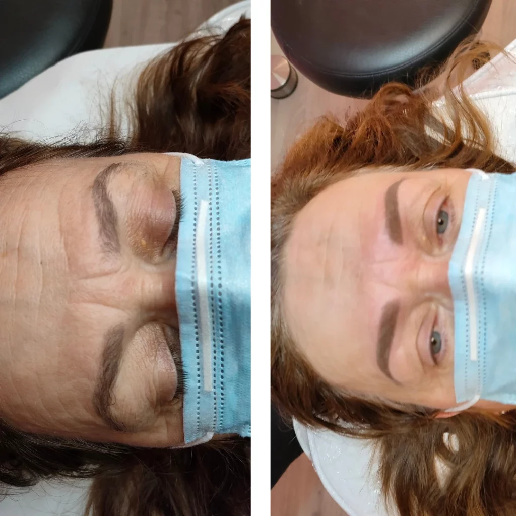 Avant après d'une femme ayant reçu une dermopigmentation des sourcils chez Derm'Ô Beauty