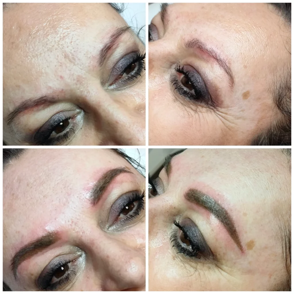 Avant après d'une femme ayant reçu une dermopigmentation des sourcils chez Derm'Ô Beauty