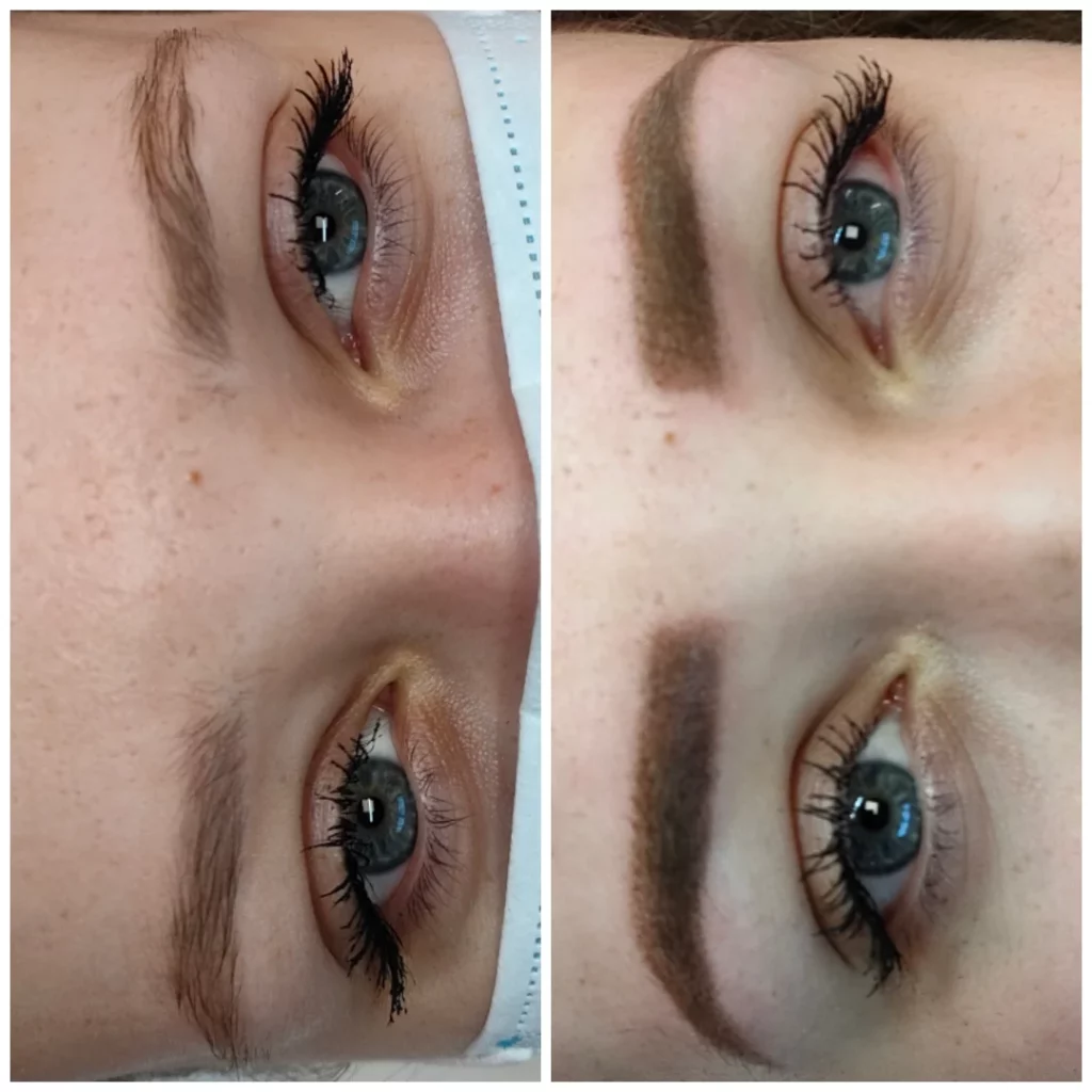 Avant après d'une femme ayant reçu une dermopigmentation des sourcils chez Derm'Ô Beauty