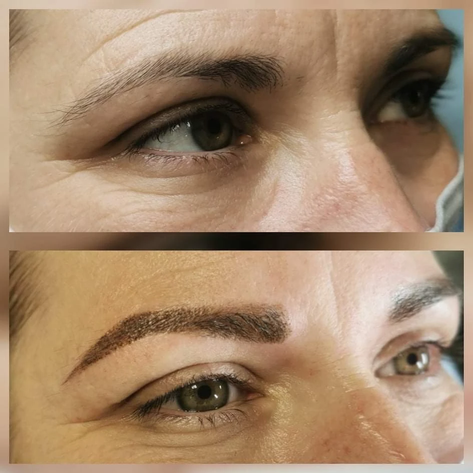 Avant après d'une femme ayant reçu une dermopigmentation des sourcils chez Derm'Ô Beauty