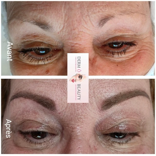 Avant après d'une femme ayant reçu une dermopigmentation des sourcils chez Derm'Ô Beauty